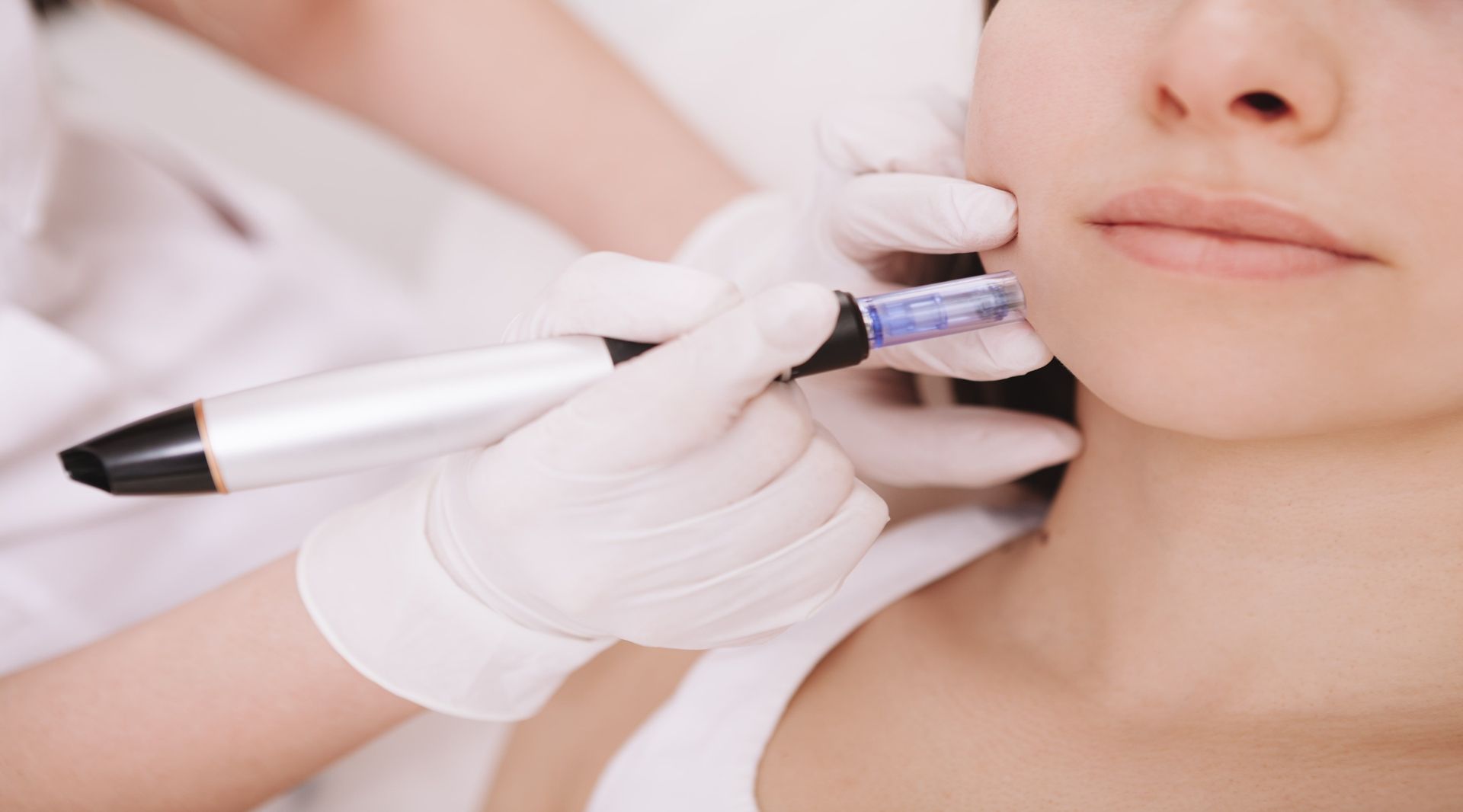 Mikrodermabrasion im Kosmetikinstitut in Heilbronn | SkinPeeler